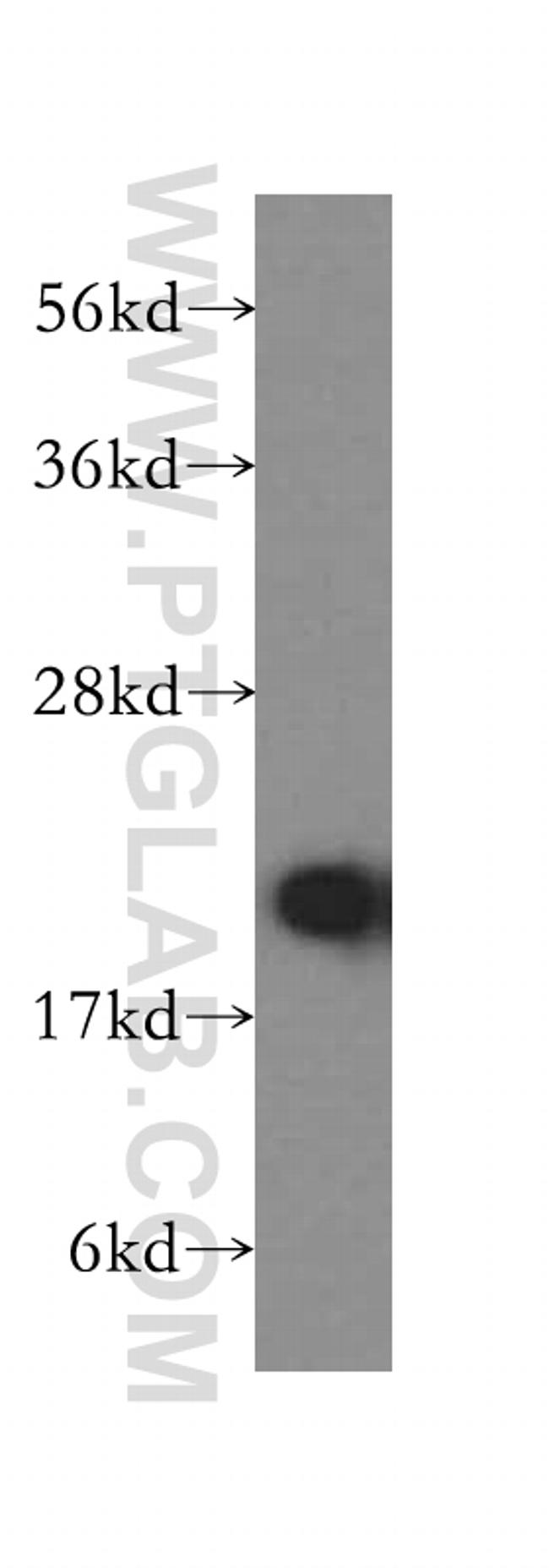 RPL11 Antibody in Western Blot (WB)