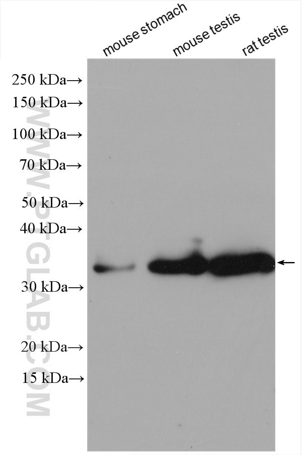 NT5C3L Antibody in Western Blot (WB)