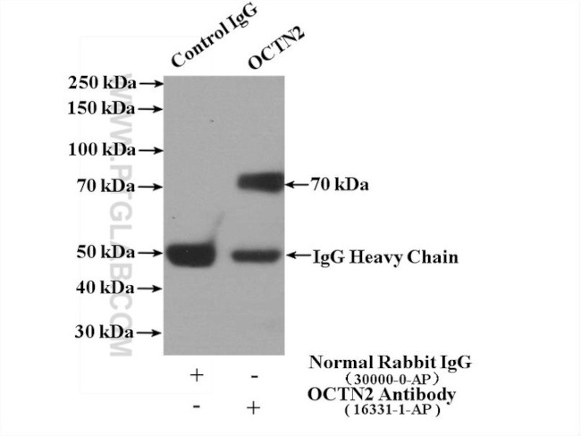 OCTN2 Antibody in Immunoprecipitation (IP)