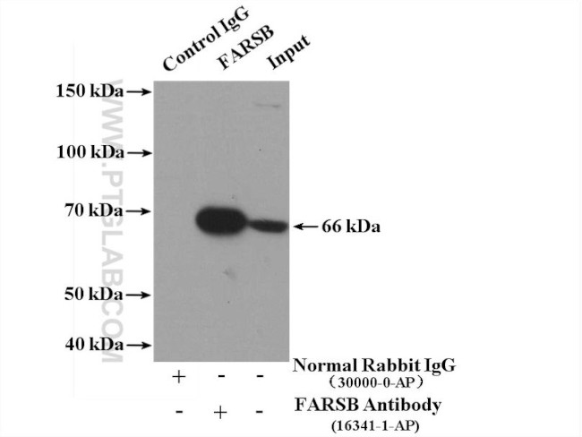 FARSB Antibody in Immunoprecipitation (IP)