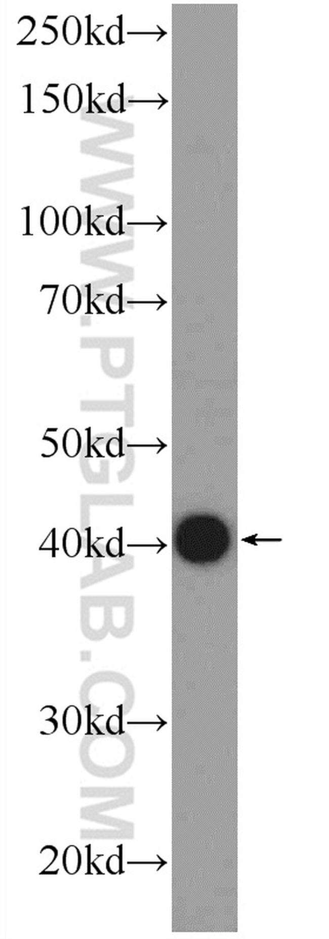 BHMT2 Antibody in Western Blot (WB)