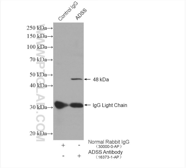 ADSS Antibody in Immunoprecipitation (IP)