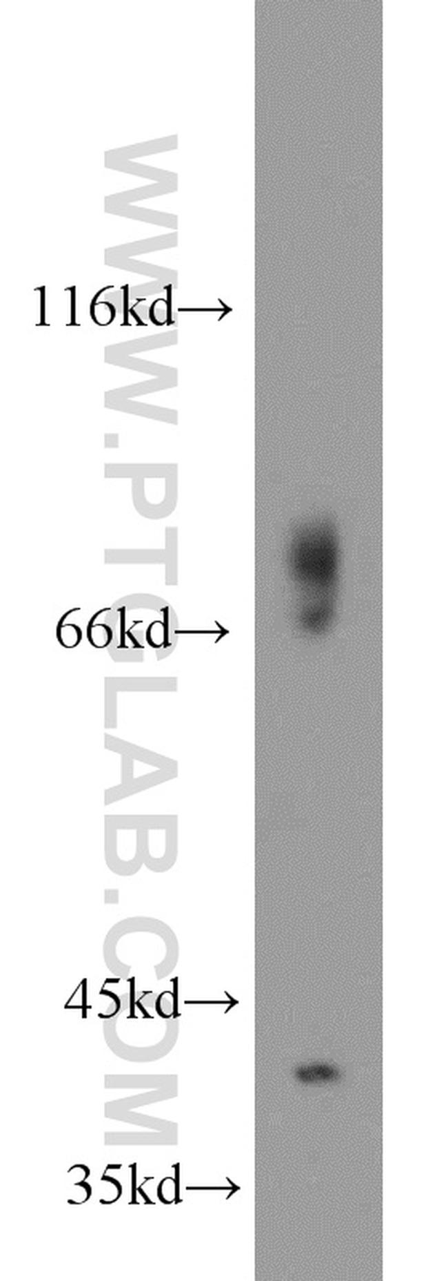 GSNOR/ADH5 Antibody in Western Blot (WB)