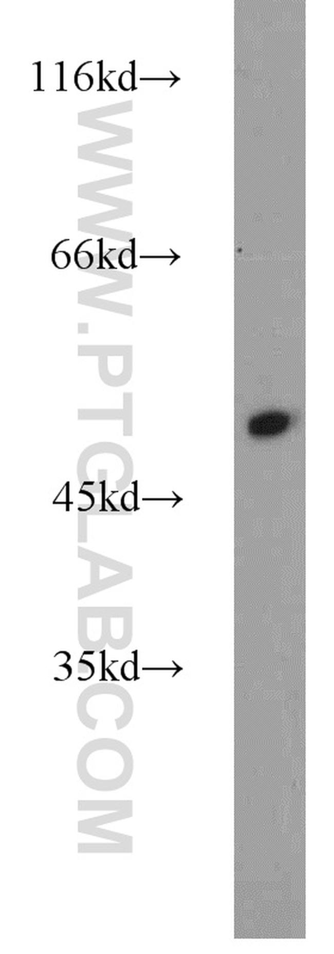 Alpha-1-Antitrypsin Antibody in Western Blot (WB)