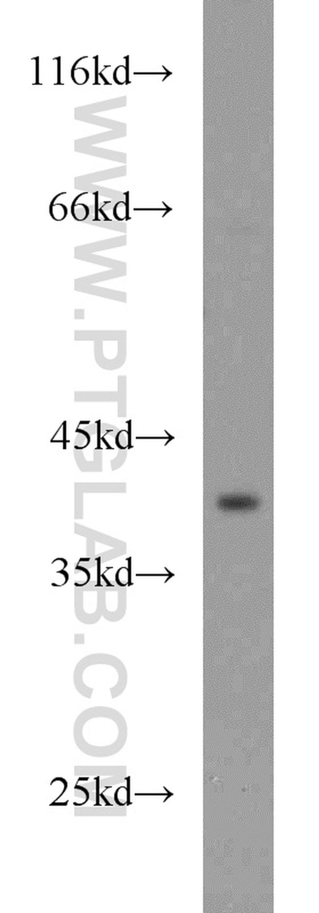 BCAT2 Antibody in Western Blot (WB)