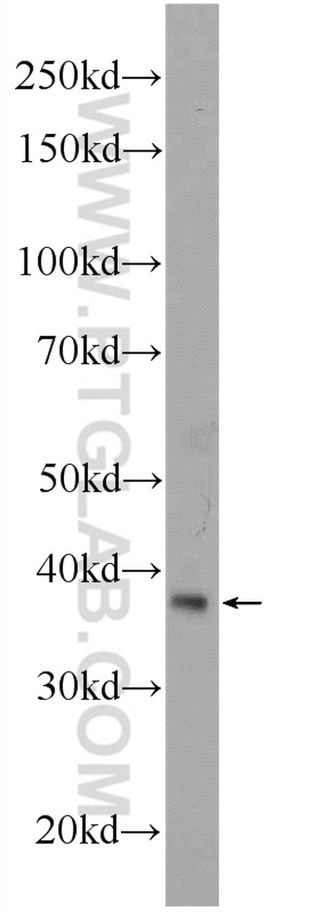 BCAT2 Antibody in Western Blot (WB)