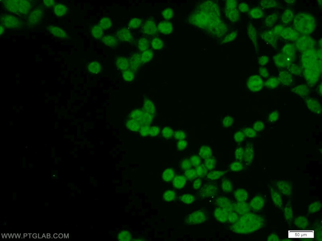 NELFB Antibody in Immunocytochemistry (ICC/IF)