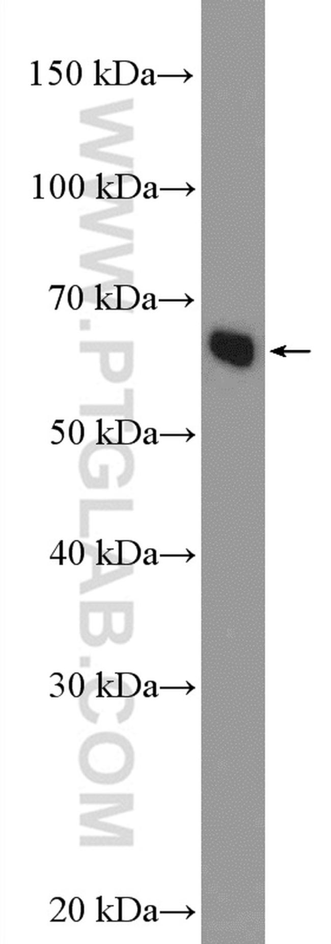 NELFB Antibody in Western Blot (WB)