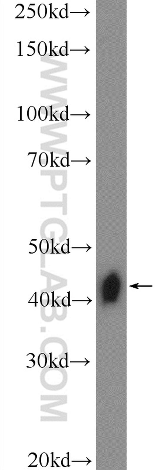 XPA Antibody in Western Blot (WB)