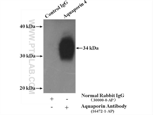 Aquaporin 4 Antibody in Immunoprecipitation (IP)