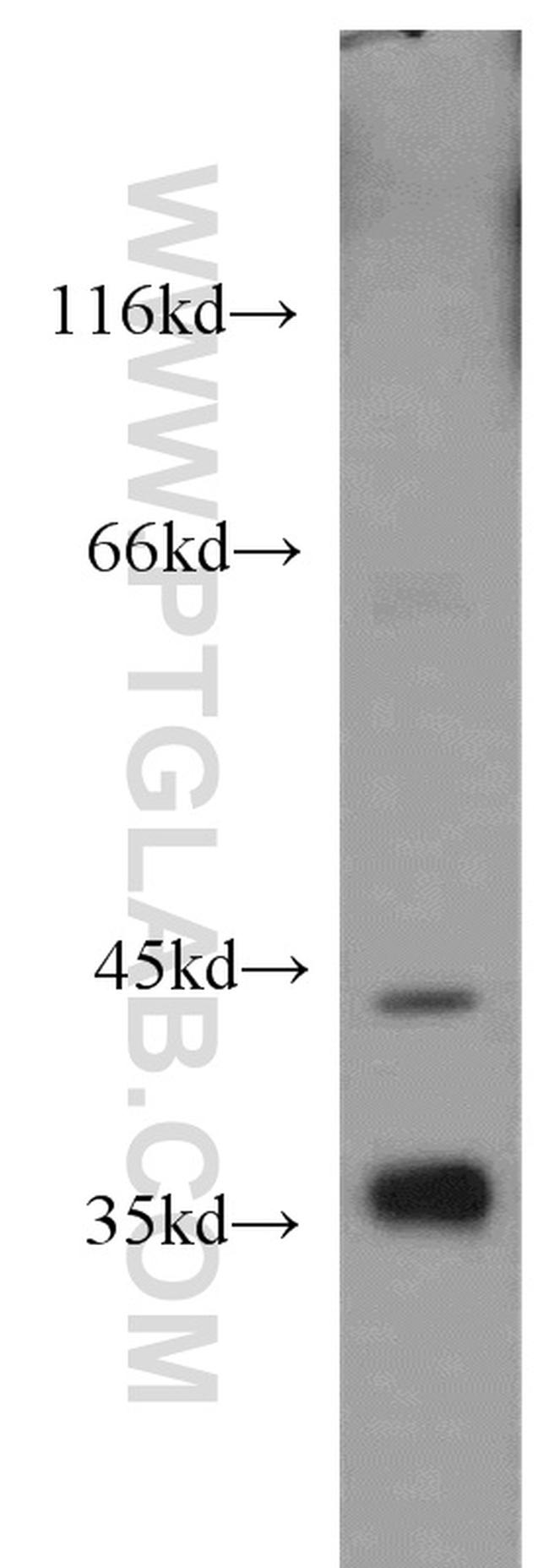 ADH4 Antibody in Western Blot (WB)