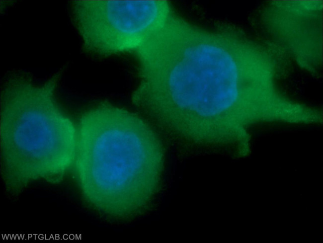 Villin Antibody in Immunocytochemistry (ICC/IF)