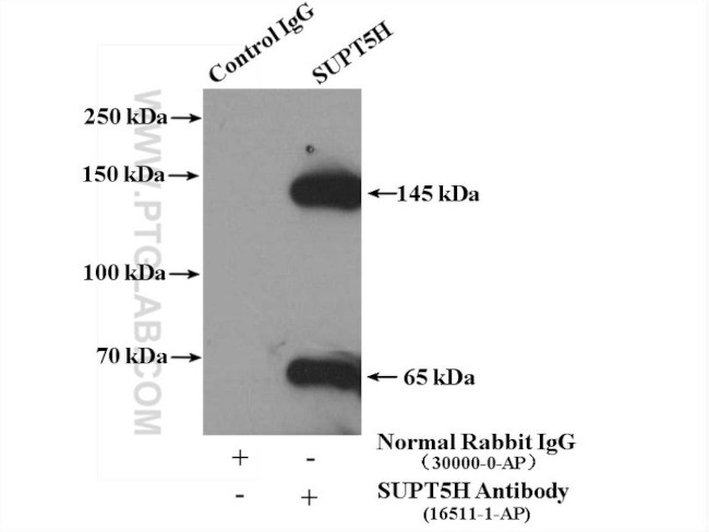 SUPT5H Antibody in Immunoprecipitation (IP)