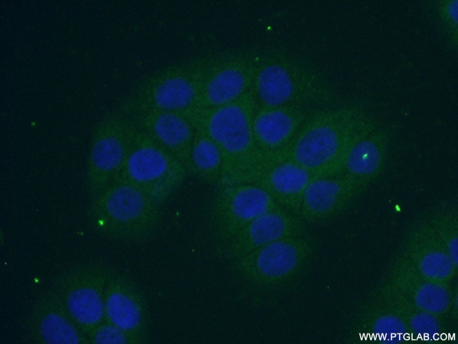 SMPDL3B Antibody in Immunocytochemistry (ICC/IF)