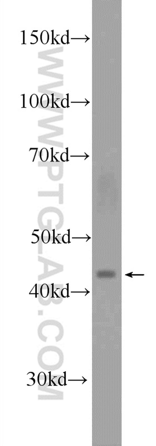 SMPDL3B Antibody in Western Blot (WB)