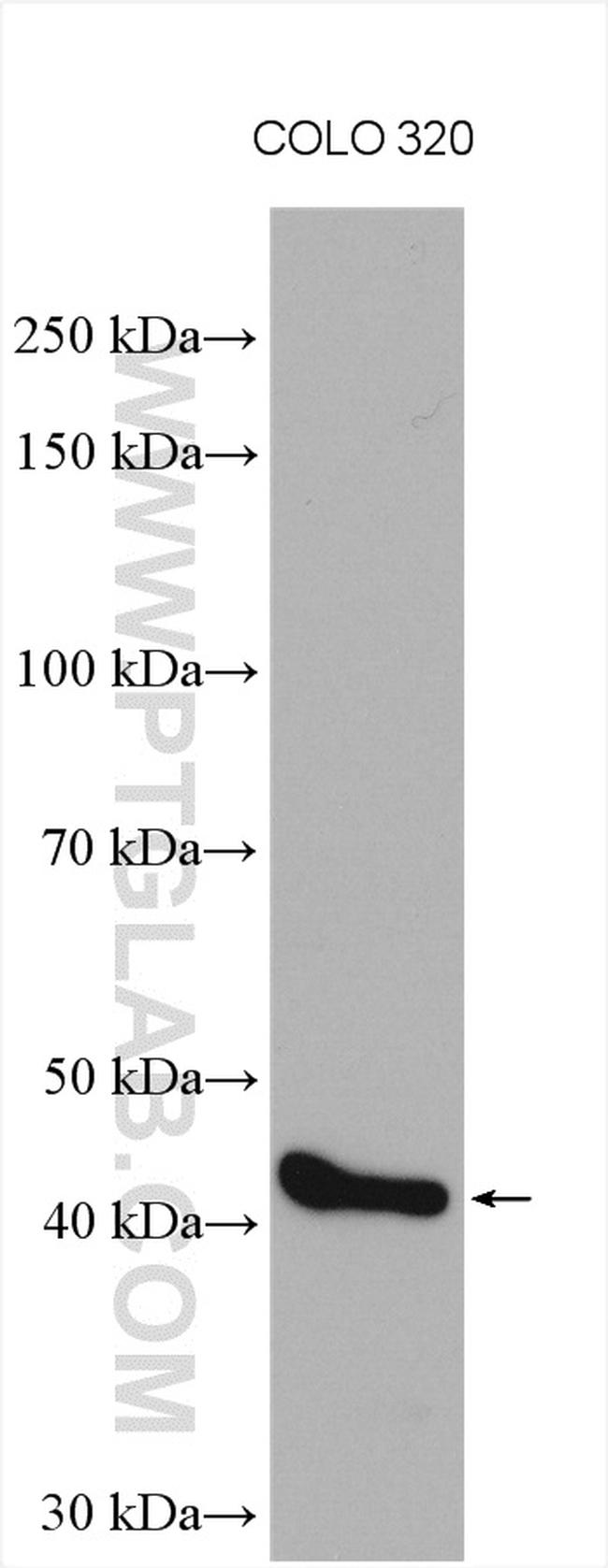 SMPDL3B Antibody in Western Blot (WB)