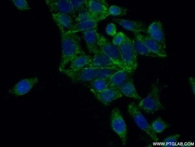 FUT6 Antibody in Immunocytochemistry (ICC/IF)