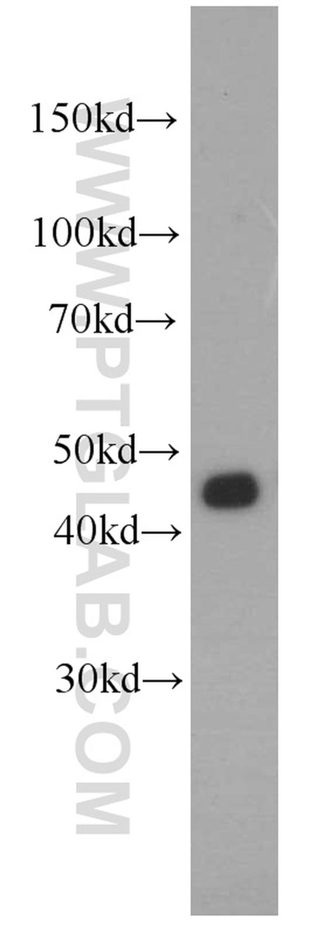 FUT6 Antibody in Western Blot (WB)
