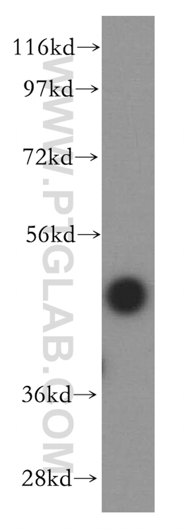 FUT6 Antibody in Western Blot (WB)