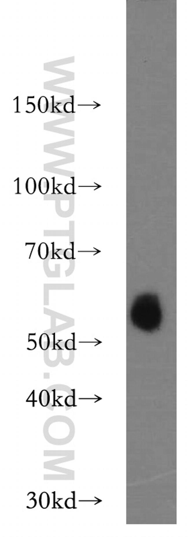 LIPH Antibody in Western Blot (WB)