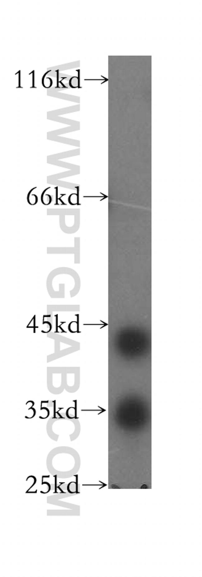 TMLHE Antibody in Western Blot (WB)