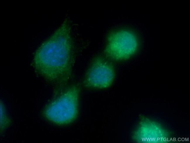 PPAR gamma Antibody in Immunocytochemistry (ICC/IF)