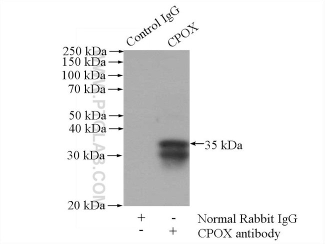 CPOX Antibody in Immunoprecipitation (IP)
