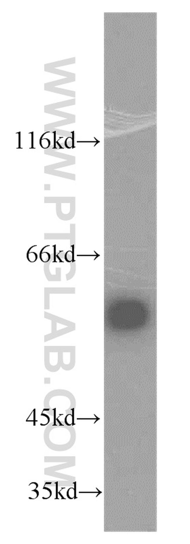 TRMT6 Antibody in Western Blot (WB)