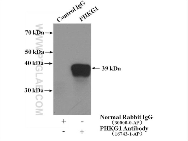 PHKG1 Antibody in Immunoprecipitation (IP)