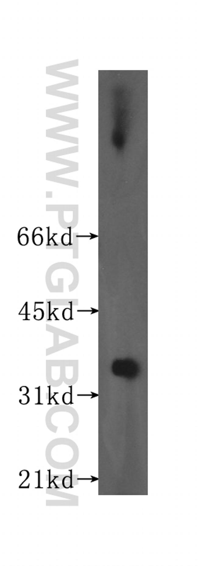 HSD17B8 Antibody in Western Blot (WB)