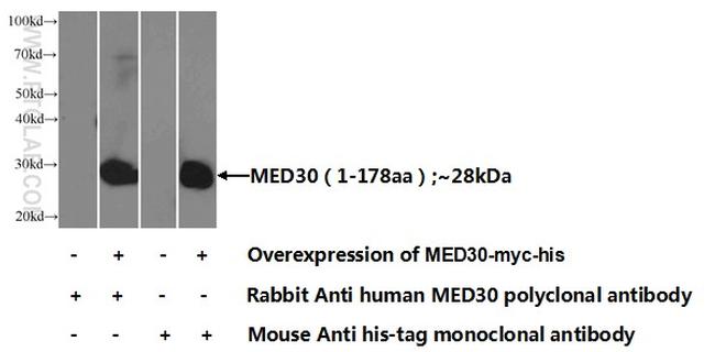 MED30 Antibody in Western Blot (WB)