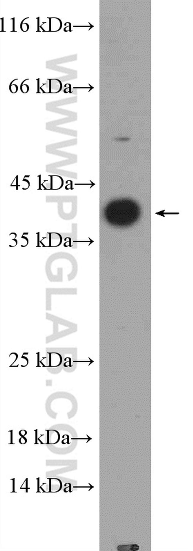 IL1 beta Antibody in Western Blot (WB)