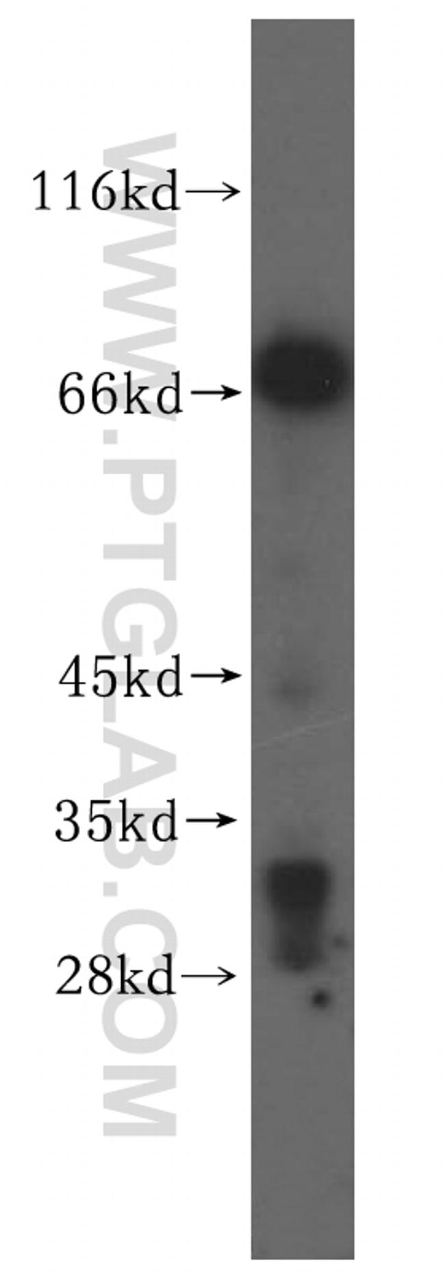 VPS33A Antibody in Western Blot (WB)