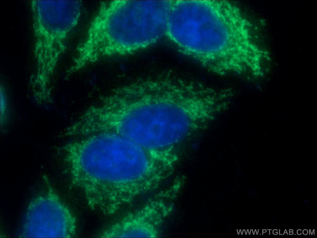 GFM2 Antibody in Immunocytochemistry (ICC/IF)