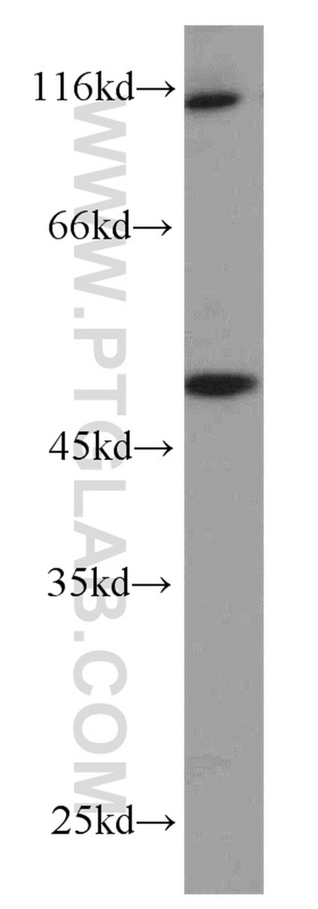 ZNF3 Antibody in Western Blot (WB)