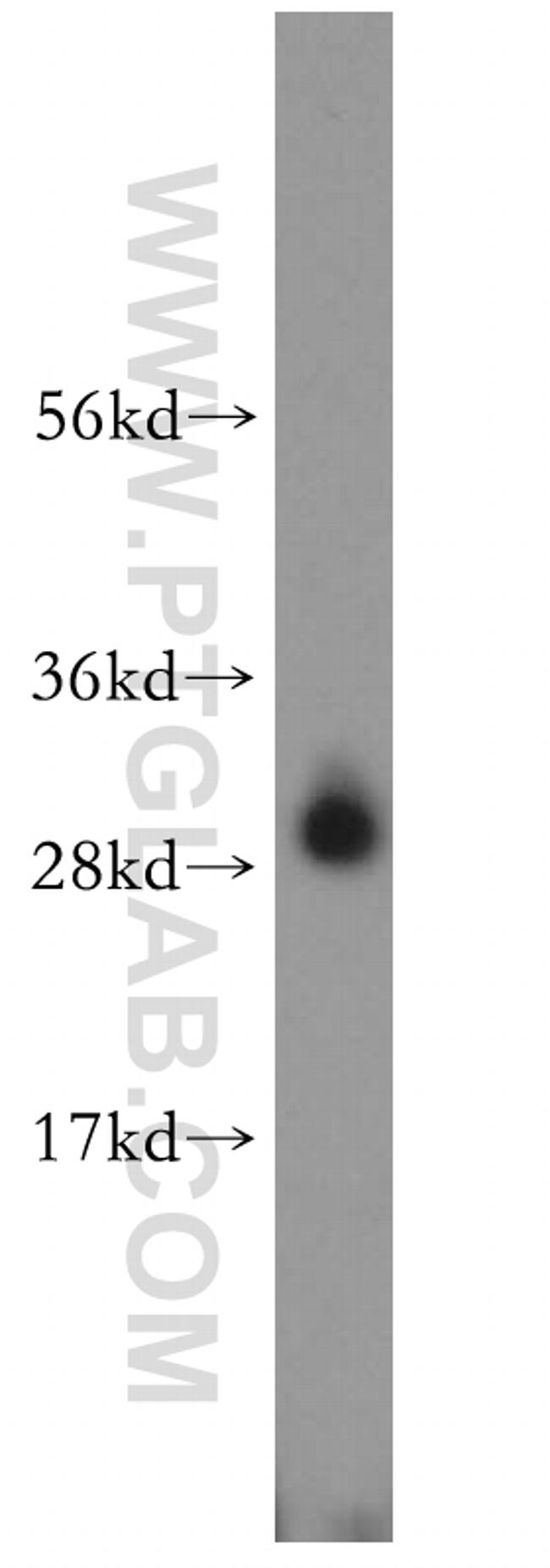 CA2 Antibody in Western Blot (WB)