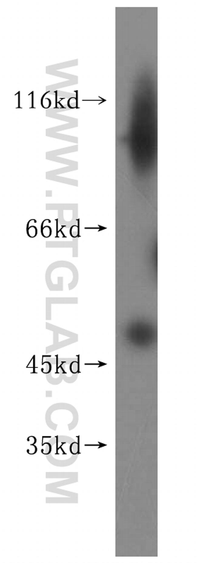 PNMAL1 Antibody in Western Blot (WB)