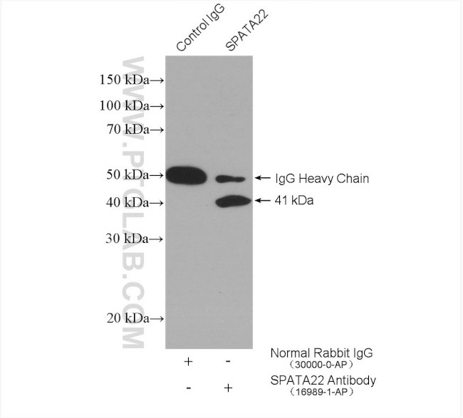 SPATA22 Antibody in Immunoprecipitation (IP)
