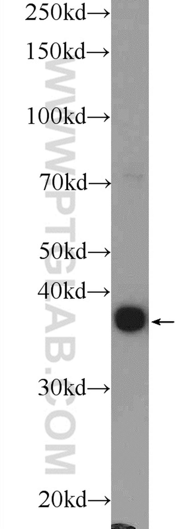 SPATA22 Antibody in Western Blot (WB)