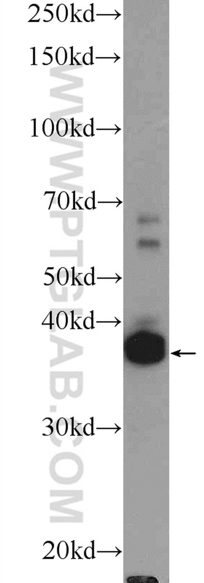 SPATA22 Antibody in Western Blot (WB)