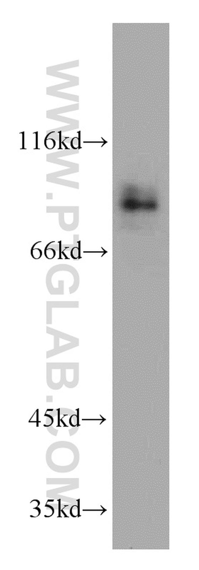 MGAT5B Antibody in Western Blot (WB)