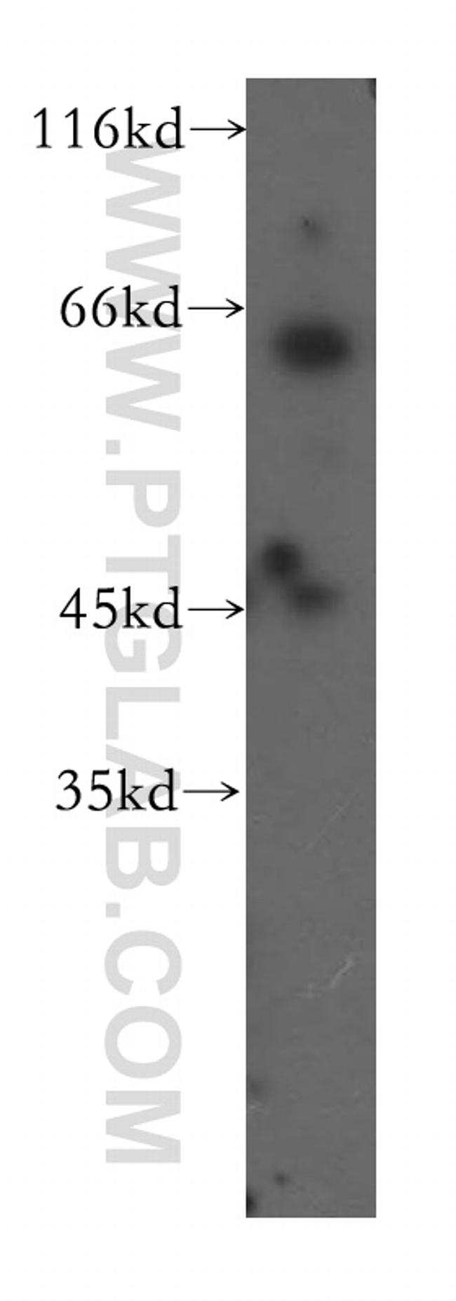 UCKL1 Antibody in Western Blot (WB)