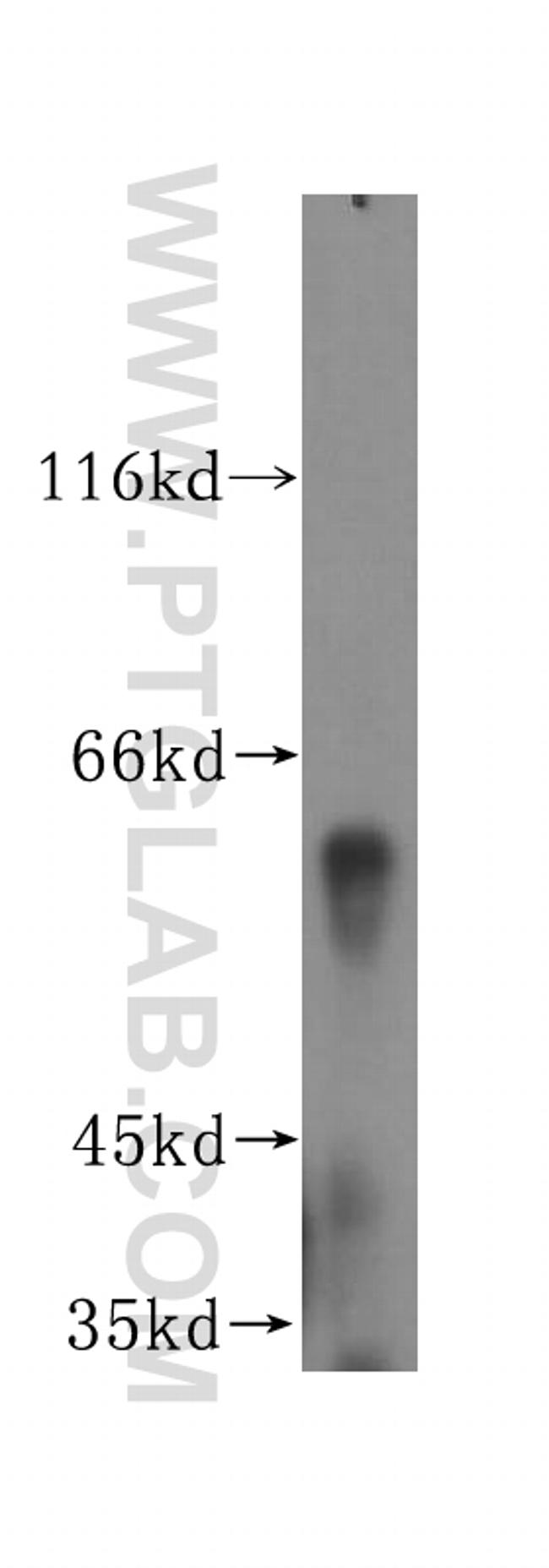 DCTN4 Antibody in Western Blot (WB)