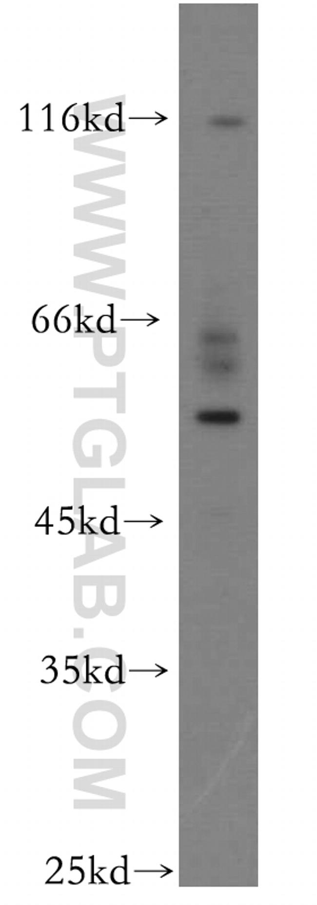 UPF3A Antibody in Western Blot (WB)