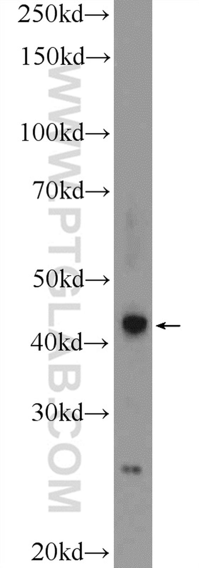 RSPO3 Antibody in Western Blot (WB)