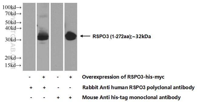 RSPO3 Antibody in Western Blot (WB)