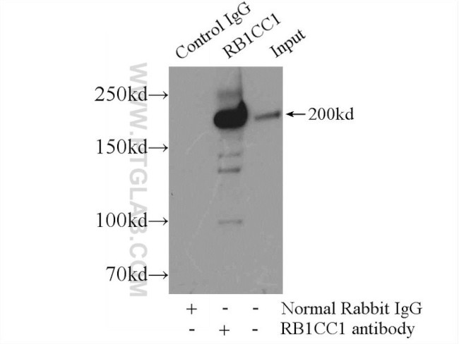 RB1CC1 Antibody in Immunoprecipitation (IP)