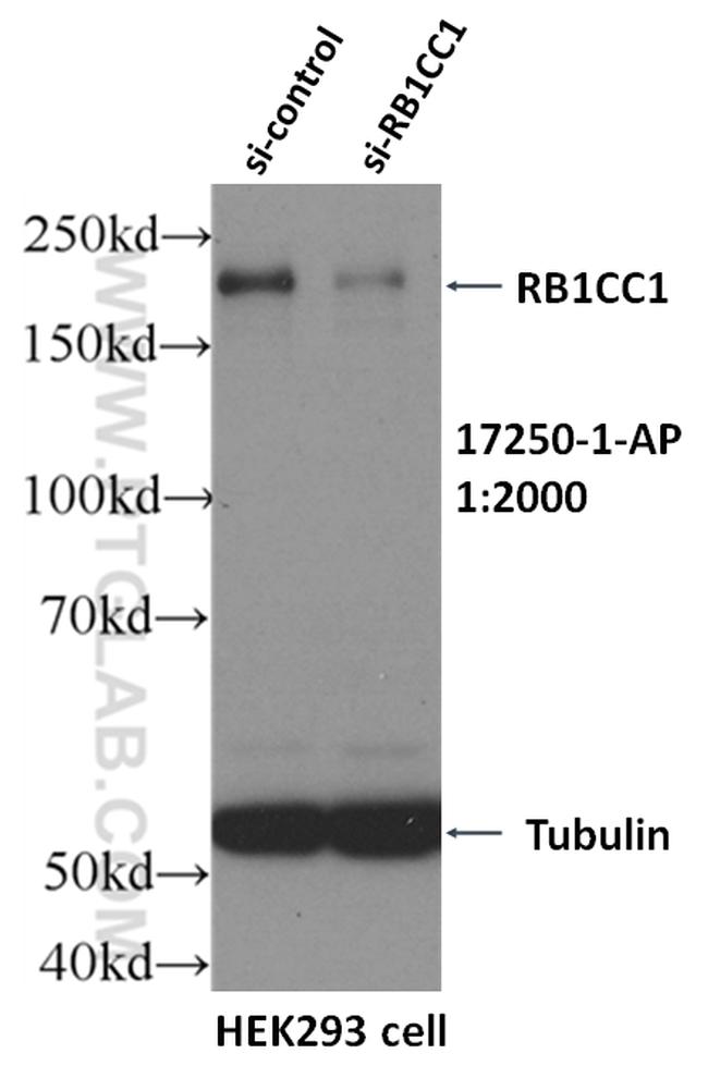 RB1CC1 Antibody in Western Blot (WB)