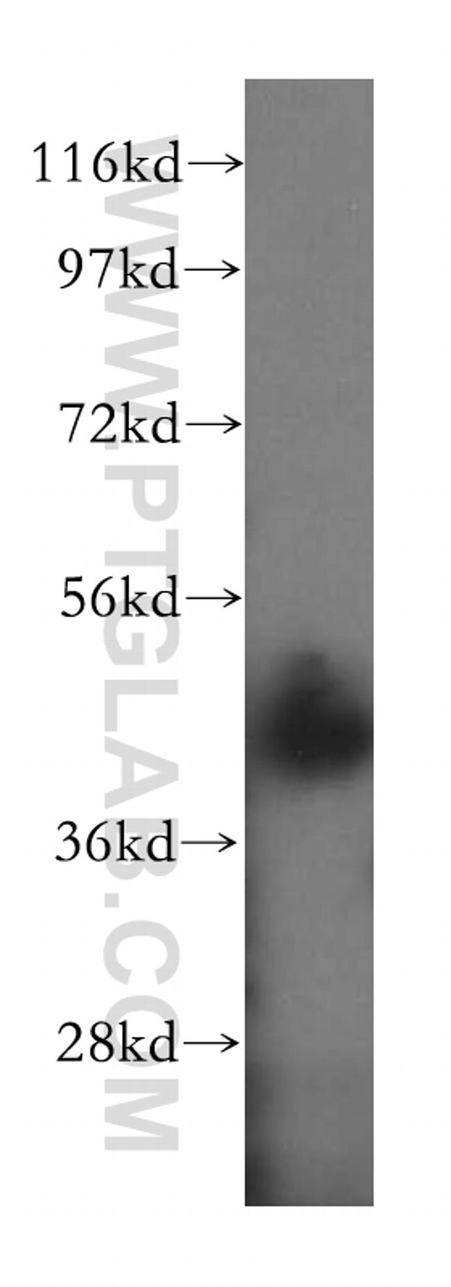 NDEL1 Antibody in Western Blot (WB)