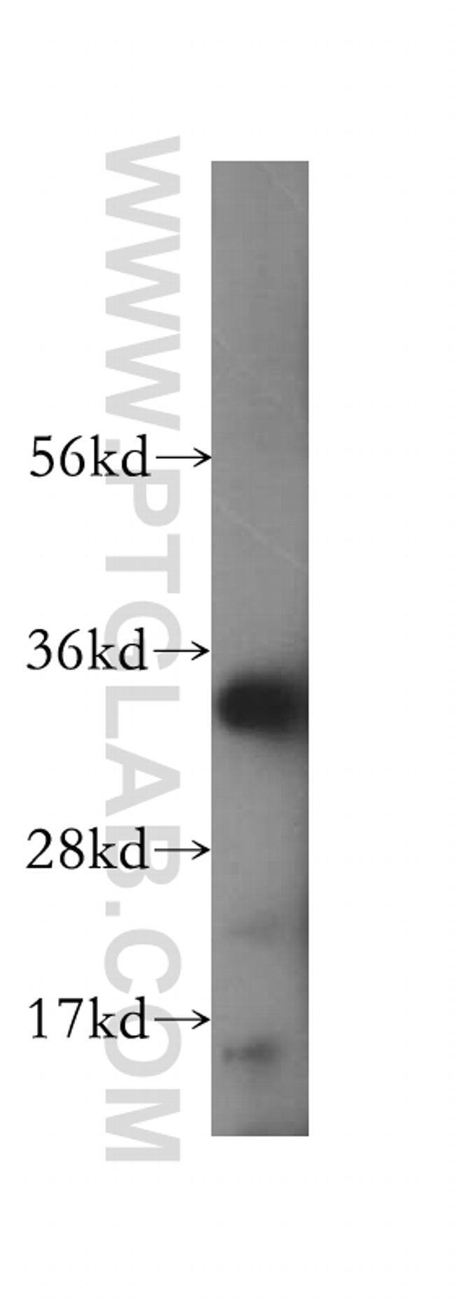 HSD17B11 Antibody in Western Blot (WB)